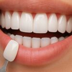 Digital Gum Contouring: Precision Smile Design Like Never Before